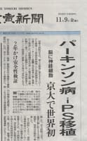 「パーキンソン病 ｉＰＳ移植…京大で世界初」